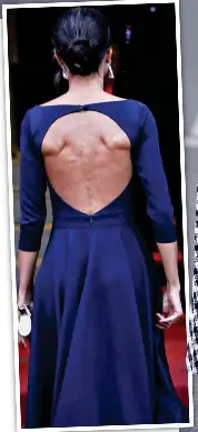 After that backless dress, Queen Letizia is now going hole out to impress -  PressReader