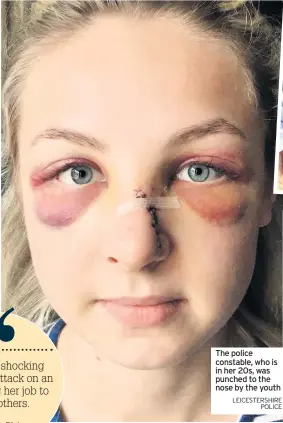  ?? LEICESTERS­HIRE POLICE ?? The police constable, who is in her 20s, was punched to the nose by the youth