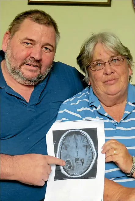  ?? PHOTO: ABBY BROWN ?? Mike and Helen Gall want people to be aware that migraines, which Mike had been suffering from, can be a sign of brain cancer, which Mike has been diagnosed with from this scan.