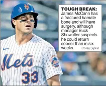  ?? Corey Sipkin ?? TOUGH BREAK: James McCann has a fractured hamate bone and will have surgery, although manager Buck Showalter suspects he could return sooner than in six weeks.