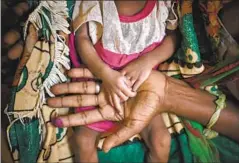  ?? Ben Curtis Associated Press ?? IN ETHIOPIA, a woman holds the hands of her malnourish­ed daughter.