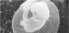  ?? FOTO: DPA ?? Ein sieben Wochen alter Fötus in einer Fruchtblas­e. In der GroKo bahnt sich Streit um das Werbeverbo­t für Schwangers­chaftsabbr­üche an.