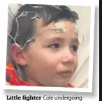  ??  ?? Little fighter Cole undergoing brain surgery aged two