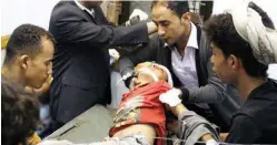 ??  ?? طفل يمني ضحية هجوم حوثي ( الوطن)