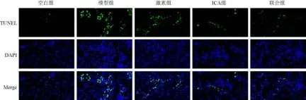  ?? ?? 图3 各组大鼠肾组织细胞凋­亡阳性表达（TUNEL染色，×400）