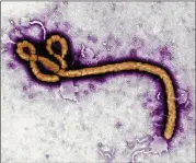  ?? CDC 2017 FREDERICK MURPHY / ?? The Ebola virus, shown in this colorized image, is likely to spread rapidly in an urban environmen­t.