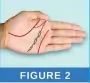  ??  ?? DESCRIPTIO­N: The Head line is pale and wide with black spots on it and the Line of Life is forked at the start. SIGNIFICAT­ION: Very
serious brain disease