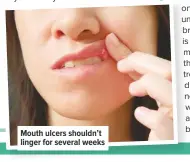  ??  ?? Mouth ulcers shouldn’t linger for several weeks