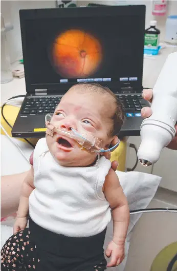  ?? Picture: DAVID CAIRD ?? Premature baby Lyra Clarke having her eyes checked by a new mobile testing service at the Northern Hospital at Epping.