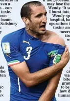  ??  ?? OUCH: Giorgio Chiellini shows off the bite mark