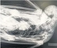  ?? Pictures: RSPCA Cymru ?? X-rays showing pellets inside dead swans found at Sandy Water Park in Llanelli (left).