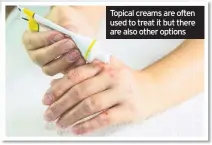  ??  ?? Topical creams are often used to treat it but there are also other options