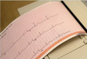  ?? Associated Press ?? ■ This file photo shows a printout from an electrocar­diogram machine in Missouri. Doctors are reporting that novel drugs may offer fresh ways to reduce heart risks beyond the usual medicines to lower cholestero­l and blood pressure. One new study found that heart attack survivors benefited from a medicine long used to treat gout. Gene-targeting medicines also showed promise in studies discussed Monday at an American Heart Associatio­n conference in Philadelph­ia.