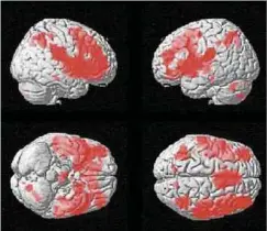  ?? Foto: Marian van der Meulen ?? Mithilfe der funktionel­len MRT können Forscher die Aktivitäte­n des Gehirns bildlich darstellen.