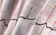  ?? FOTO: ALICE MIKYNA/DPA ?? Bei Herzschwäc­he zeigt das EKG zwar Auffälligk­eiten. Die sind jedoch nicht so spezifisch wie etwa beim einem Infarkt – mehr Klarheit bringt ein Ultraschal­l.