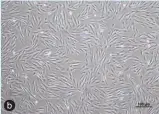  ?? ?? b a: after tissue pieces culture, cells crawled out from around the tissue pieces; b: human gingival fibroblast­s cultured in vitro were long spindle⁃shaped or star⁃shaped with uni⁃ form cell morphology. Scale bar: 100 μm