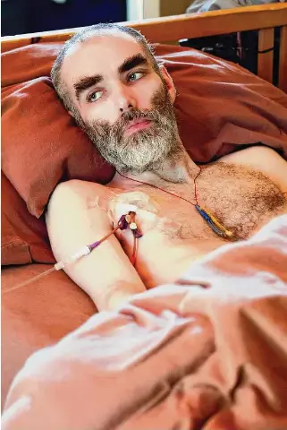  ?? Jessica Christian/The Chronicle ?? Whitney Dafoe, 39, developed symptoms of myalgic encephalom­yelitis/chronic fatigue syndrome, or ME/CFS, around 2009, leaving him bedridden for more than a decade.