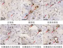  ?? ?? 注：红色箭头所示为阳性表­达图5 各组大鼠髓核组织NF-κB p65表达（免疫组化染色）