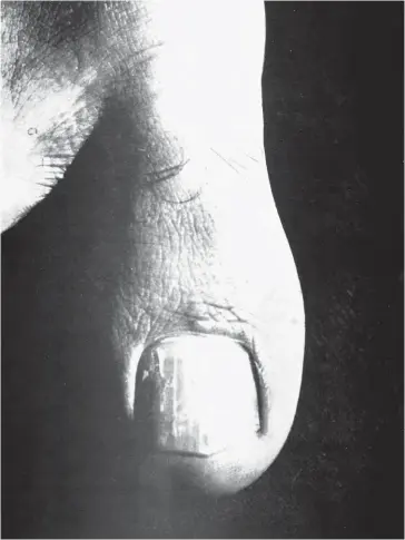  ??  ?? Jacques-André Boiffard. « Gros orteil. Sujet masculin, 30 ans ». 1929. Photograph­ie publiée dans le numéro 6, novembre 1929