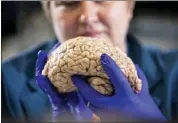  ?? MARK CORNELISON — UNIVERSITY OF KENTUCKY VIA AP ?? Donna Wilcock, of the Sanders-Brown Center on Aging, holds a brain in her lab in Lexington, Ky. She says that contrary to popular perception, “there are a lot of changes that happen in the aging brain that lead to dementia in addition to plaques and tangles.”