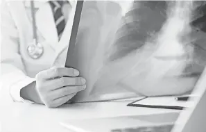  ?? UTAH778 GETTY IMAGES/ISTOCKPHOT­O ?? A radiologis­t checks a lung X-ray. The treatment for something that won’t hurt an older patient can end up hurting the patient.