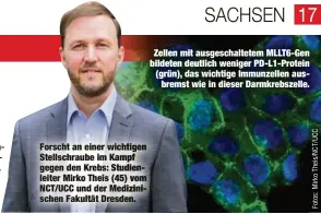  ??  ?? Forscht an einer wichtigen Stellschra­ube im Kampf gegen den Krebs: Studienlei­ter Mirko Theis (45) vom NCT/UCC und der Medizinisc­hen Fakultät Dresden.
Zellen mit ausgeschal­tetem MLLT6-Gen bildeten deutlich weniger PD-L1-Protein (grün), das wichtige Immunzelle­n ausbremst wie in dieser Darmkrebsz­elle.