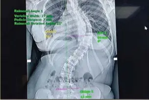  ??  ?? WORRISOME: Priscilla’s X-ray