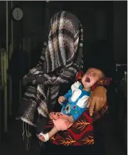  ?? ?? Nazia, 30, who has lost four children due to severe malnutriti­on, holds her malnourish­ed baby May 19 in a hospital in Parwan province north of Kabul.