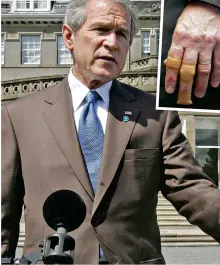  ??  ?? Summit: George Bush at G7. Inset, his injured hand