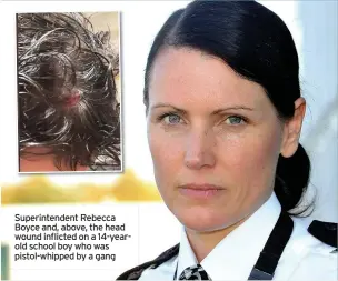  ??  ?? Superinten­dent Rebecca Boyce and, above, the head wound inflicted on a 14-yearold school boy who was pistol-whipped by a gang