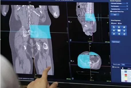  ?? — Bernama photos ?? The display of a type of cancer can be seen at the Radiothera­py and Oncology Department of Hospital Kuala Lumpur.