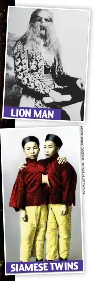  ??  ?? SIAMESE TWINS LION MAN