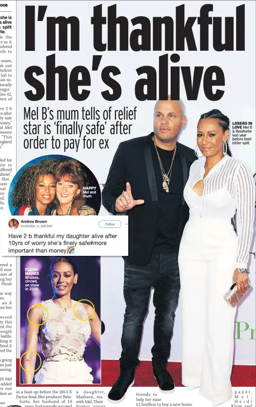  ??  ?? FLESH MARKS Bruises, circled, on show in 2014 HAPPY Mel and mum LOSERS IN LOVE Mel B &amp; Belafonte last year before their bitter split