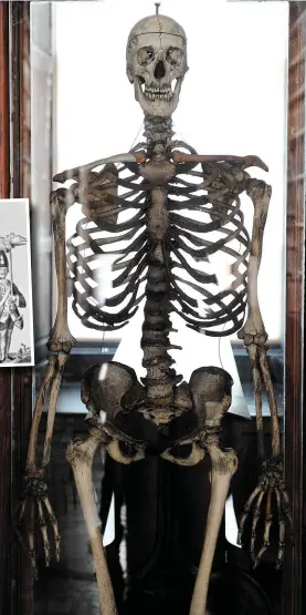  ?? Photo: Paul Sharp. Inset, an 18th-Century engraving of Magrath. ?? The skeleton of Cornelius Magrath (1736-60) in Trinity College.