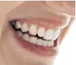  ?? ARCHIVFOTO ?? Mit gesunden Zähnen lacht man gerne. Implantate, die auch im hohen Alter eingesetzt werden, sorgen nicht nur für die Optik. Mit ihnen lässt es sich auch wieder vernünftig kauen.