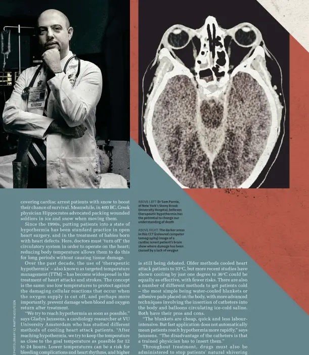  ??  ?? ABOVE RIGHT: The darker areas in this CCT (coloured computer tomography) image of a cardiac arrest patient’s brain show where damage has been caused by a lack of oxygen
ABOVE LEFT: Dr Sam Parnia, of New York’s Stony Brook University Hospital, believes...