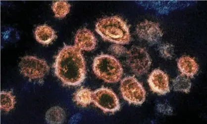  ??  ?? An electron microscope image shows the virus that causes Covid-19 Photograph: Alamy Stock Photo