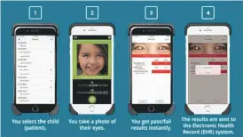  ?? GOCHECK KIDS ?? Pediatrici­ans can use an iPhone loaded with software to identify vision abnormalit­ies.