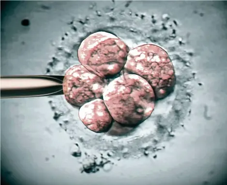  ?? (ZEPHYR/SCIENCE PHOTO LIBRARY) ?? Un embryon prêt à être implanté dans l’utérus d’une femme 72 heures après avoir été soumis à une fécondatio­n in vitro. A ce stade de son évolution, il est composé de quatre à huit cellules.