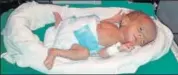  ?? HT PHOTO ?? The newborn baby girl weighing 830 grams was admitted to the NICU at the district hospital in Dholpur.