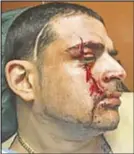  ??  ?? David Marrero was attacked at Rikers Island by a fellow inmate.