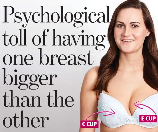  ??  ?? C CUP Mismatch: Leah Knight, 24, is self-conscious of her uneven cleavage E CUP