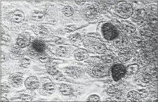  ?? THE CANADIAN PRESS-DR. E. ARUM; DR. N. JACOBS ?? This photomicro­graph reveals McCoy cell monolayers with Chlamydia trachomati­s inclusion bodies. Chlamydia, caused by Chlamydia trachomati­s, is the most common bacterial sexually transmitte­d infection.