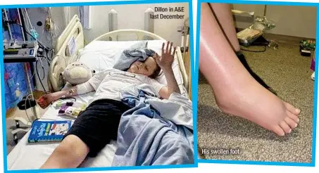  ?? ?? Dillon in A&E last December
His swollen foot
