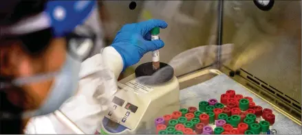  ?? NEW YORK TIMES FILE ?? With interferon­s, a critical factor may be getting the timing right. The new studies suggest interferon would be most helpful in the earliest stages of the disease, but that window may close before most people are hospitaliz­ed and doctors can treat them.