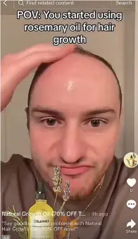  ?? ?? One TikTok user showing his once-thinning hair, left, and, right, the results from rosemary oil