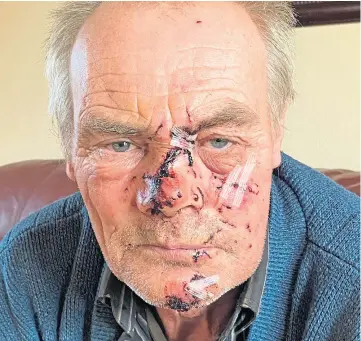  ?? ?? SAVAGED: Sandy Brown fears he may be scarred for life after being bitten by a dog.