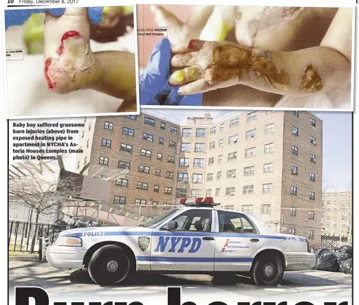  ??  ?? Baby boy suffered gruesome burn injuries (above) from exposed heating pipe in apartment in NYCHA’s Astoria Houses complex (main photo) in Queens.