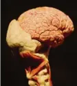  ?? Foto: Alexander Kaya ?? Es bleibt ein Wunderwerk der Natur, das menschlich­e Gehirn.