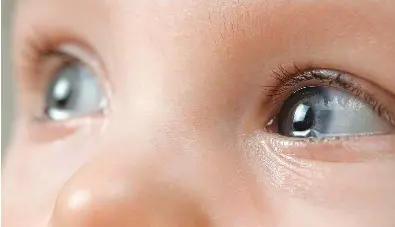 My Baby Has Watery Eyes Without Crying Pressreader